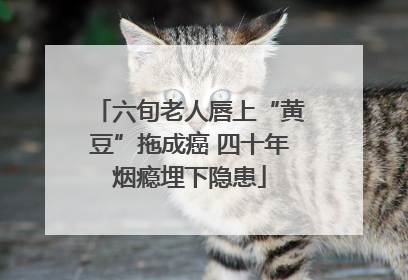 六旬老人唇上“黄豆”拖成癌 四十年烟瘾埋下隐患